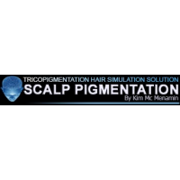 Scalp Pigmentation Ireland - Scalp Micropigmentation Treatment, Buncrana