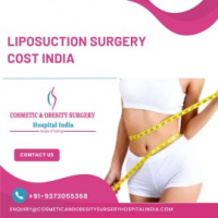 Best price for Liposuction Surgery In India, Mumbai
