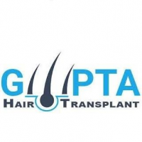 Gupta Hair Transplant in Ludhiana, Ludhiana