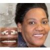 Dental Implants (Affordable Teeth Implants)