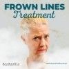 Frown Lines Treatment available at Dermedica