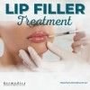 Lip Filler Treatment available at Dermedica